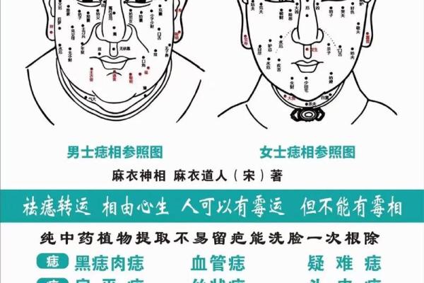 痣相学：了解痣的位置和形态是否能预测命运