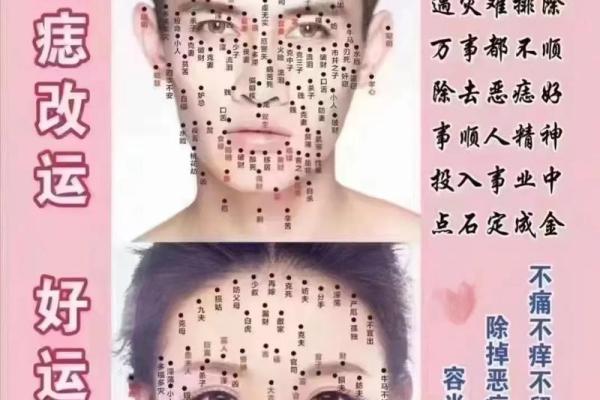 面相解读：痣瘊的神秘寓意与人生启示